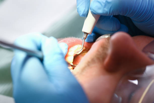Best Holiday Emergency Dentist in San Andreas, CA