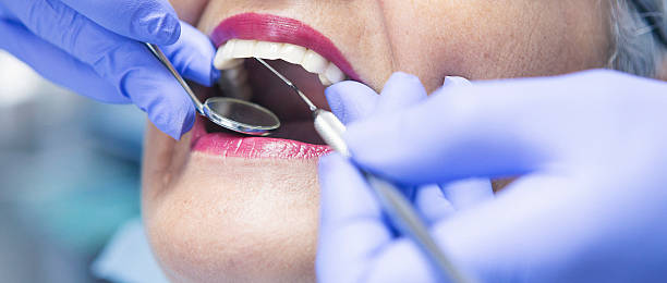 Best Emergency Dental Care for Abscessed Tooth in San Andreas, CA
